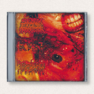 Sebum Excess Production / Kyst / Tumbero CD